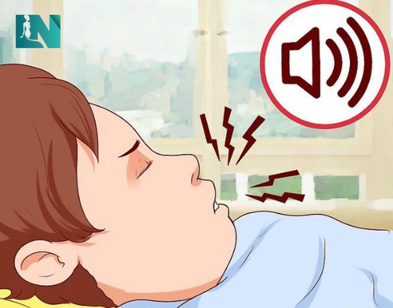 Mỡ tích tụ nhiều ở vùng cằm là một trong những nguyên nhân dẫn đến tình trạng ngủ ngáy