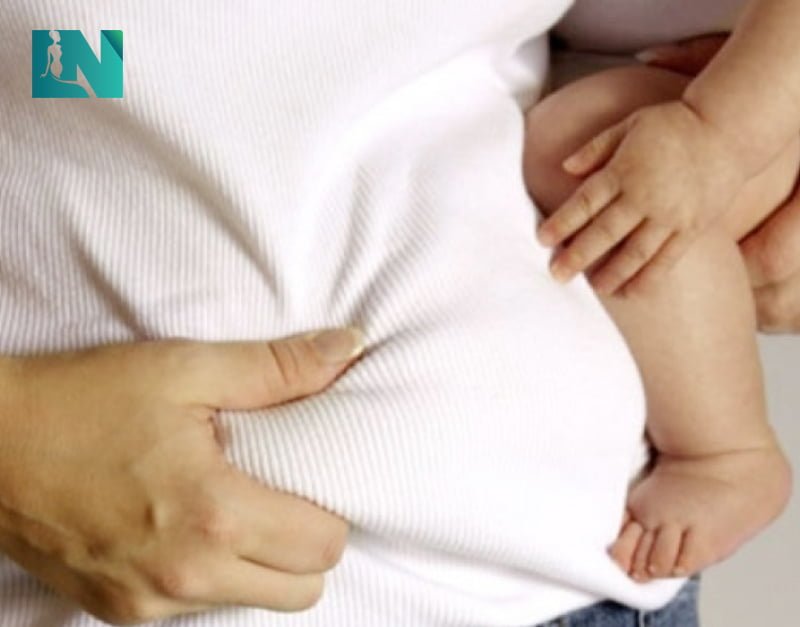 Có bao lâu sau sinh (sinh mổ hoặc sinh thường) thì có thể hút mỡ bụng?
