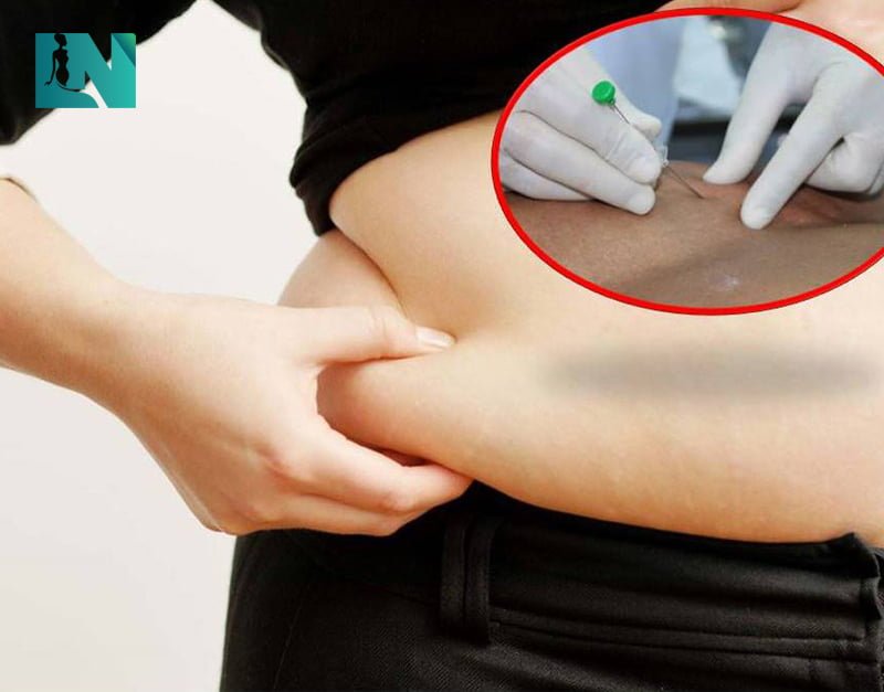 Những mũi tiêm tan mỡ “đắt đỏ”