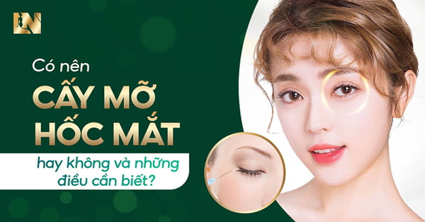 Có nên cấy mỡ hốc mắt hay không và những điều cần biết